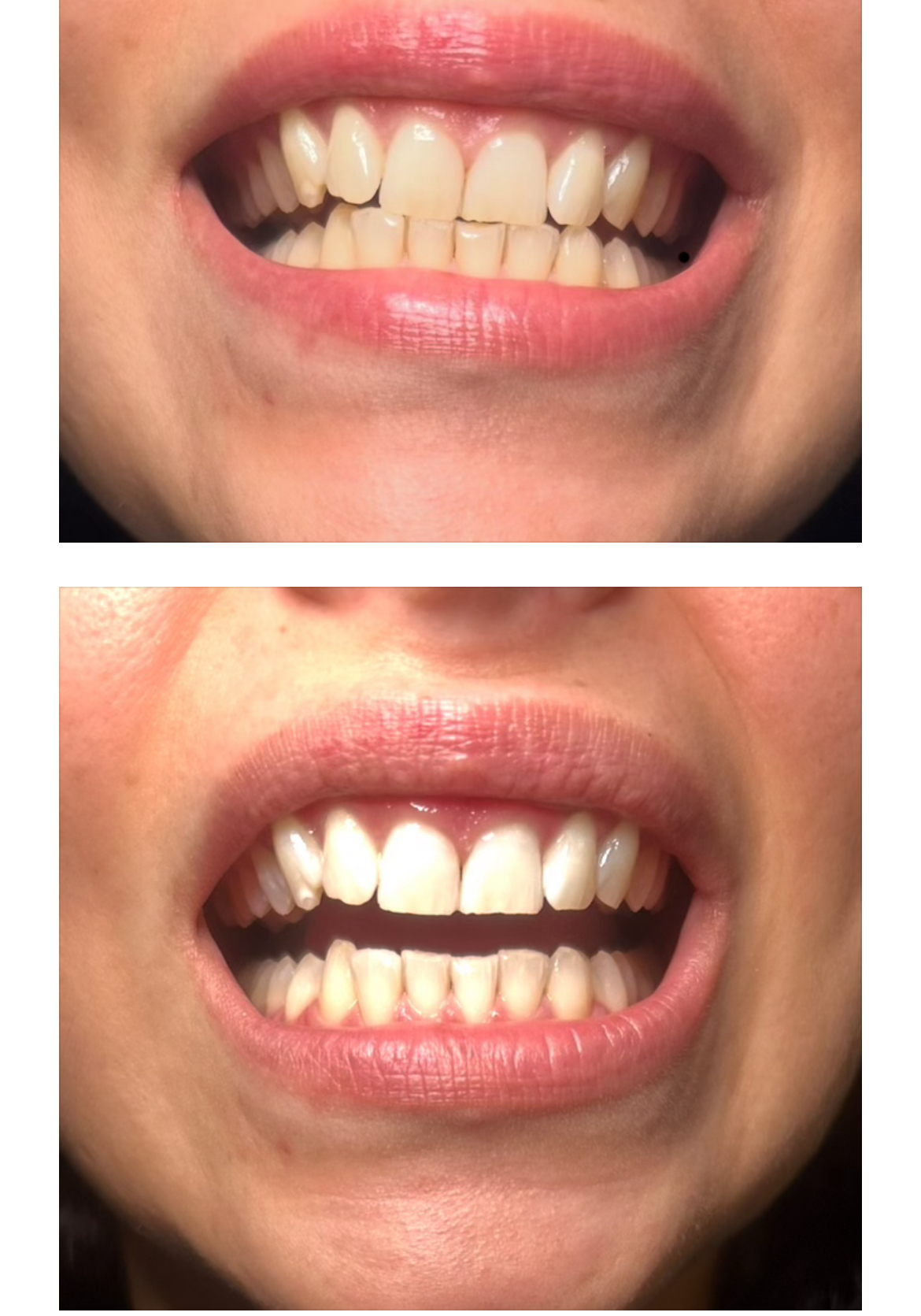 Before and After