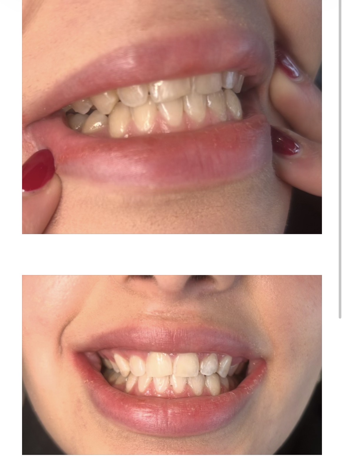 Before and After
